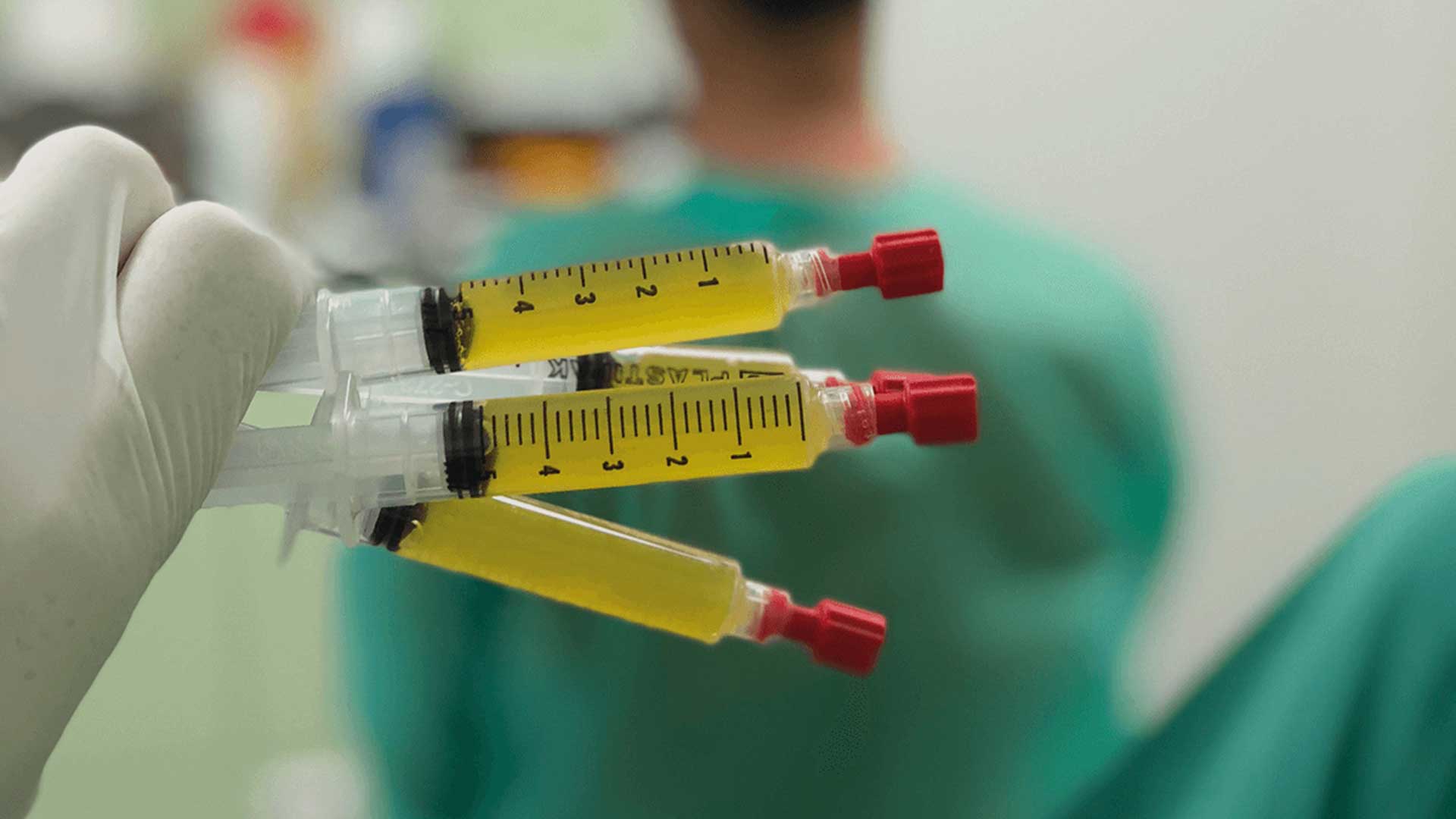 prp-eigenbluttherapie